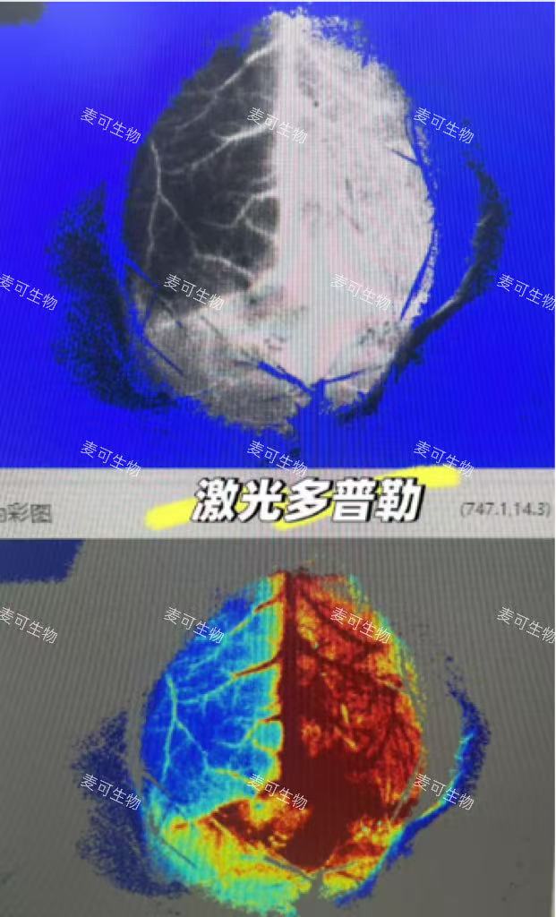 激光散斑